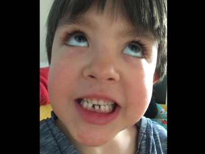 the tooth that took all the space